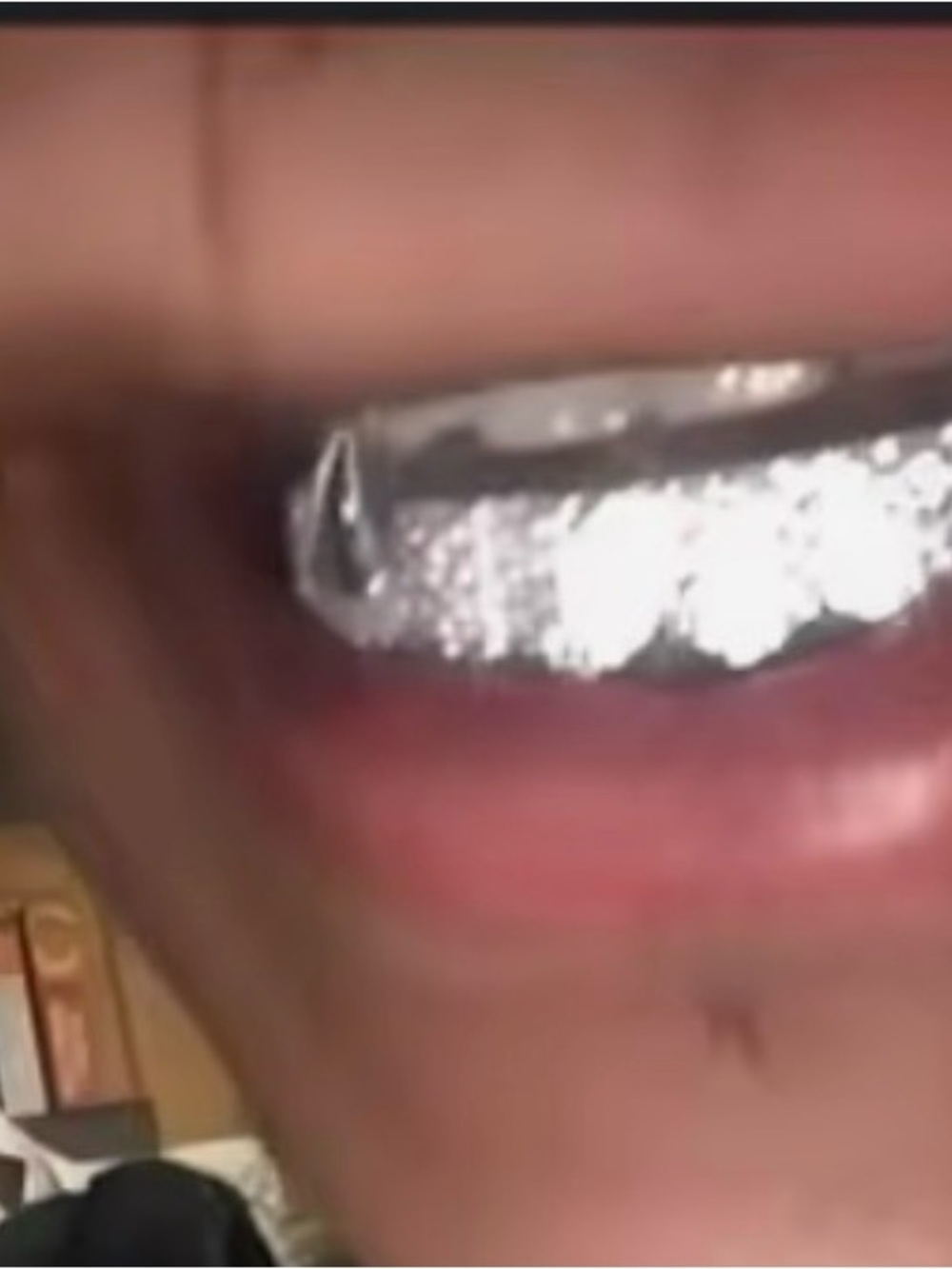 ICED OUT GRILL SET TOP AND BOTTOM WHITE GOLD GP FANG NEW !!!